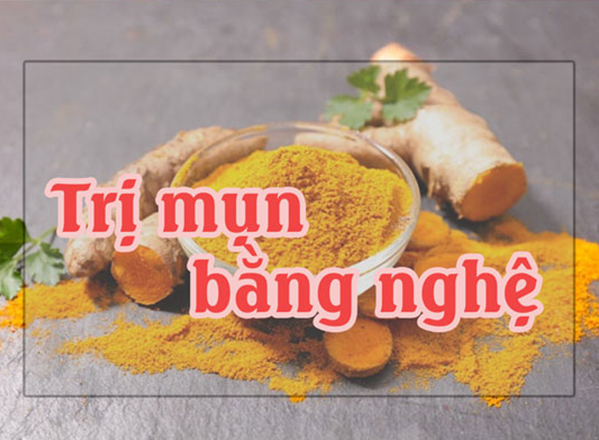 Những cách trị mụn bằng nghệ tươi để có da đẹp đón Tết