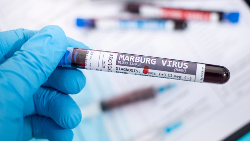 Tăng cường giám sát, phòng chống dịch bệnh Marburg đặc biệt nguy hiểm xâm nhập