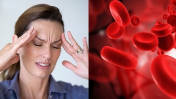 Người bị thiếu máu não nên và không nên ăn gì để tránh bệnh nặng thêm?