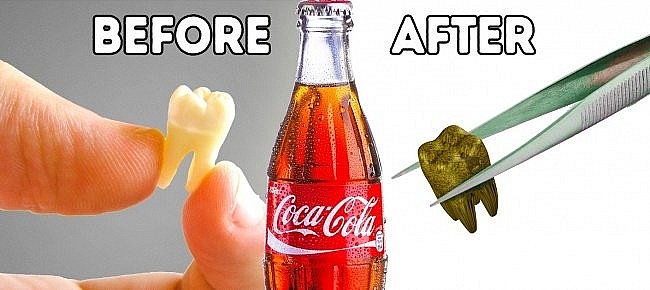 Những tác hại của việc sử dụng coca cola quá nhiều và thường xuyên