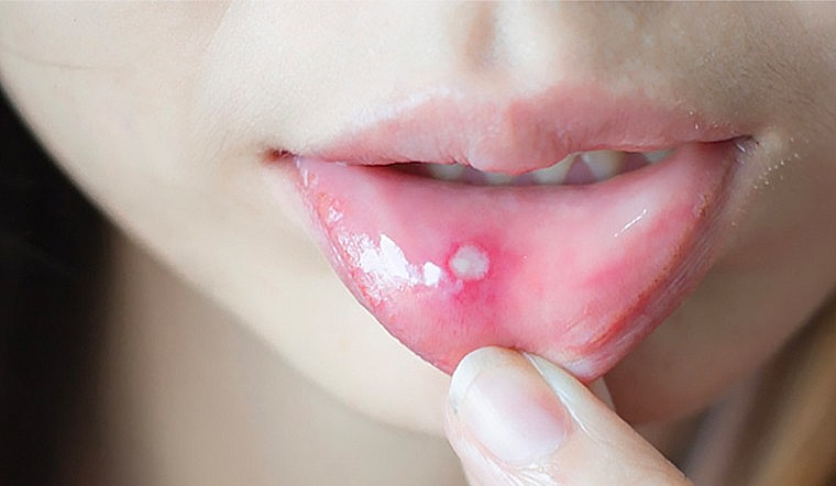 Bắt quả tang 2 cơ sở giết mổ heo trái phép
