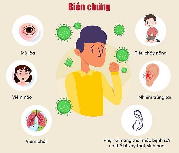 Thủ tướng yêu cầu đẩy nhanh tiêm chủng vaccine phòng, chống bệnh Sởi