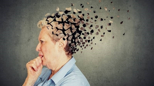 Hay quên sau tuổi 40, coi chừng bệnh Alzheimer