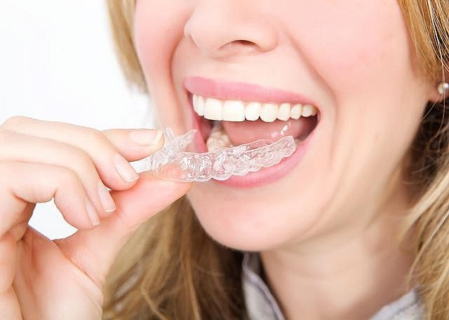 Sau khi gắn khí cụ, người niềng răng sẽ đối mặt với một số vấn đề trong sinh hoạt.