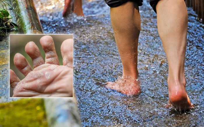 Phát hiện sớm và phòng ngừa bệnh ngoài da mùa mưa lũ